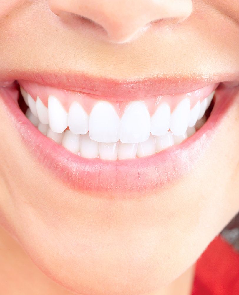 Close-up of a white smile